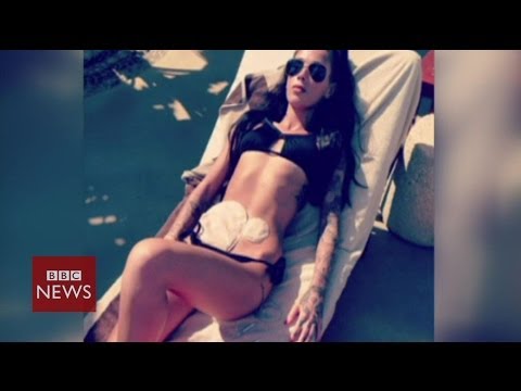 Crohn’s disease model Bethany Townsend shows colostomy bags – BBC News